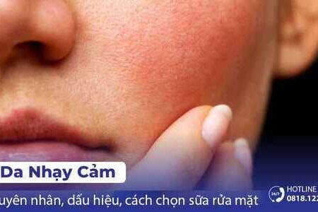 Da nhạy cảm là da gì? Dấu hiệu nhận biết da nhạy cảm!