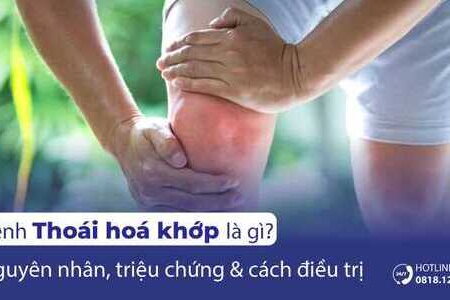 Thoái hoá khớp là gì? Nguyên nhân, triệu chứng và cách điều trị