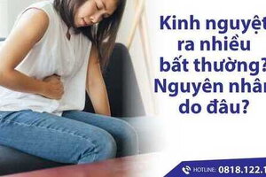 Kinh nguyệt ra nhiều bất thường - Nguyên nhân và cách điều trị