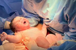 Sản phụ 29 tuổi sinh mổ bé trai có cân nặng 'khủng' 