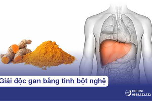 Giải độc gan bằng tinh bột nghệ và những điều cần biết