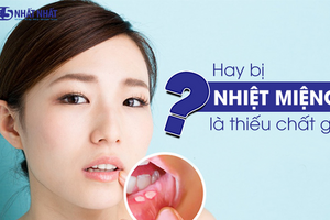 Hay bị nhiệt miệng là thiếu chất gì?