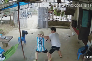 Làm rõ vụ bé trai bạch tạng bị ông nội của bạn hành hung dã man