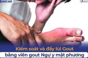 Kiểm soát và đẩy lùi gout hiệu quả bằng Viên gout Ngự y mật phương
