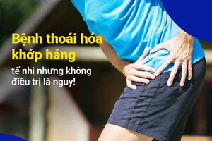 Bệnh thoái hóa khớp háng: tế nhị nhưng không điều trị là nguy!