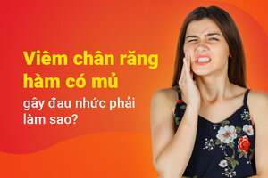 Viêm chân răng hàm có mủ gây đau nhức phải làm sao?