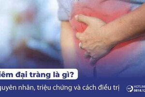 Viêm đại tràng là gì? Nguyên nhân, triệu chứng và điều trị