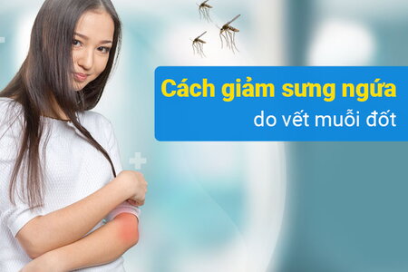 Tổng hợp các cách giảm sưng ngứa do vết muỗi đốt nhanh chóng