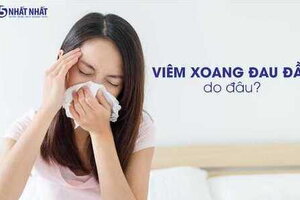 Viêm xoang đau đầu do đâu?