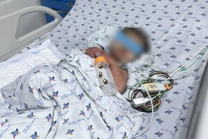 Bé trai 27 tháng tuổi nguy kịch do sốc sốt xuất huyết trên nền bệnh tim bẩm sinh