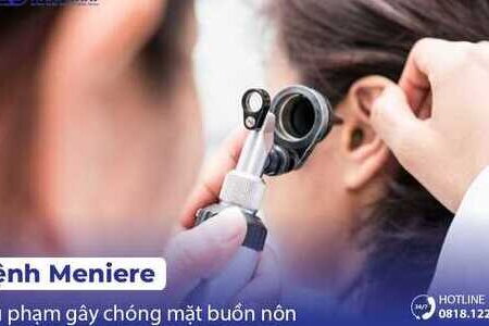 Bệnh Meniere – thủ phạm nguy hiểm gây chóng mặt buồn nôn