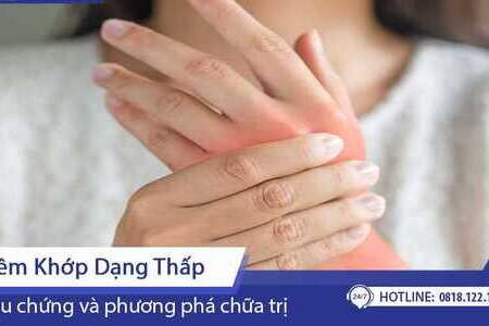 Triệu chứng và phương pháp chữa trị viêm khớp dạng thấp