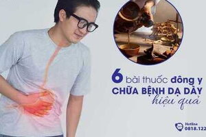 6 bài thuốc đông y chữa các bệnh dạ dày (đau, viêm loét...) hiệu quả