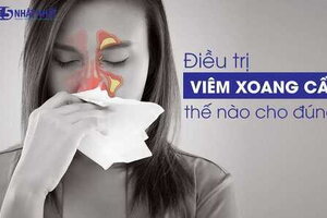 Điều trị viêm xoang cấp thế nào cho đúng?