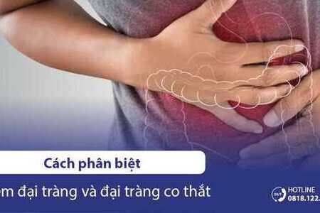 Cách phân biệt viêm đại tràng và đại tràng co thắt