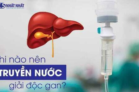 Khi nào nên truyền nước giải độc gan?