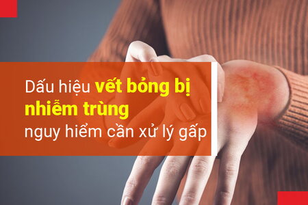 Dấu hiệu vết bỏng bị nhiễm trùng nguy hiểm cần xử lý gấp