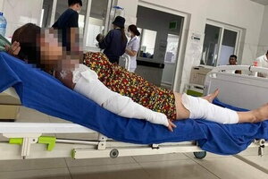 Bình gas mini phát nổ trong bữa ăn, 7 người nhập viện cấp cứu