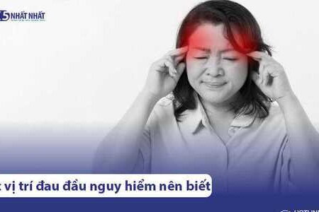 7 vị trí đau đầu nguy hiểm cần cảnh giác cao độ