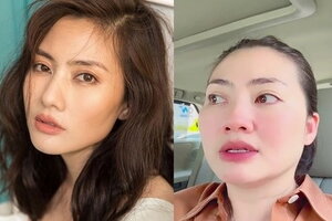 Bộ Tài chính chỉ đạo rà soát hợp đồng bảo hiểm của diễn viên Ngọc Lan, Công ty MVI Life lên tiếng