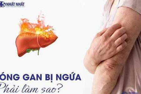 Nóng gan bị ngứa, phát ban phải làm sao?