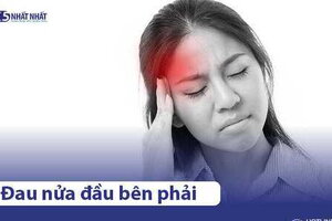 Đau nửa đầu bên phải: Nguyên nhân, triệu chứng & cách điều trị