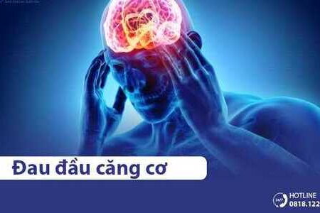 Đau đầu căng cơ: Nguyên nhân, triệu chứng & cách điều trị