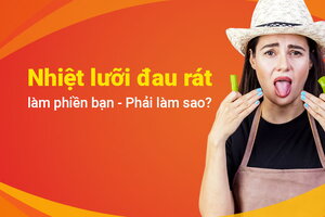 Nhiệt lưỡi đau rát làm phiền bạn – Phải làm sao?