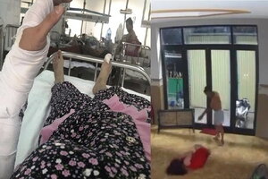 Đà Nẵng: Công an điều tra vụ chồng đóng cửa đánh vợ phải nhập viện