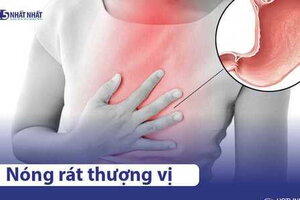 Nóng rát thượng vị là bệnh gì? Có nguy hiểm không? Điều trị ra sao?