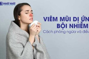 Viêm mũi dị ứng bội nhiễm: Phòng ngừa và điều trị