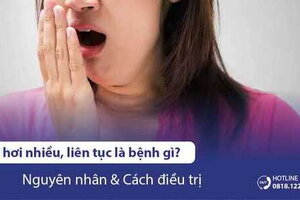 Ợ hơi nhiều, liên tục là bệnh gì? Nguyên nhân & cách điều trị