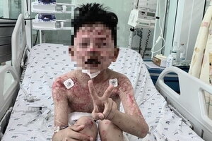 Bé trai 8 tuổi nổi sẩn khắp người, nguy kịch sau 2 ngày ăn cua