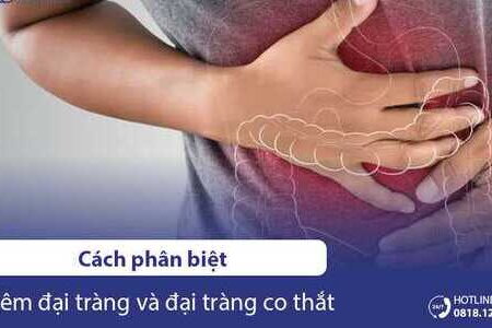 Cách phân biệt viêm đại tràng, đại tràng co thắt