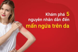 Khám phá 5 nguyên nhân dẫn đến mẩn ngứa trên da