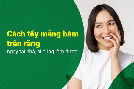 Cách tẩy mảng bám trên răng ngay tại nhà, ai cũng làm được 