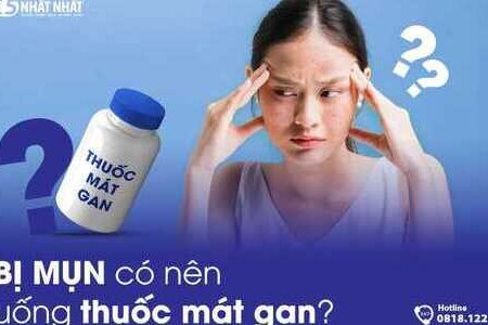 Bị mụn có nên uống thuốc mát gan?