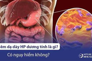 Viêm dạ dày HP dương tính là gì? Có nguy hiểm không?