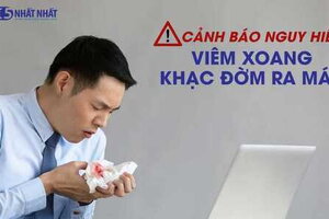 [Cảnh báo nguy hiểm] Viêm xoang khạc đờm ra máu