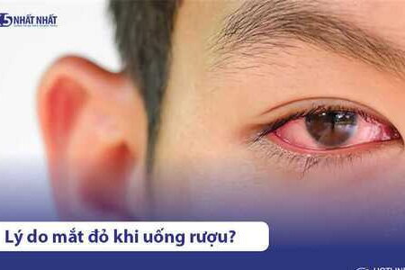 Lý do mắt bị đỏ khi uống rượu bia & cách xử lý