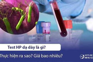 Test HP dạ dày là gì? Thực hiện ra sao? Giá bao nhiêu?