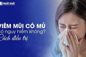 Viêm mũi có mủ có nguy hiểm không? Cách điều trị