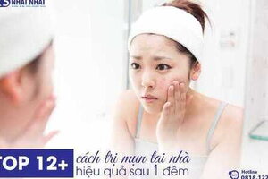 TOP 12+ cách trị mụn tại nhà hiệu quả sau 1 đêm