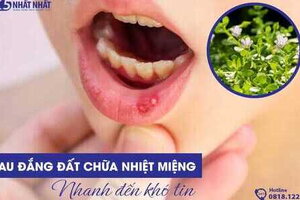 Rau đắng đất chữa nhiệt miệng khỏi nhanh đến khó tin