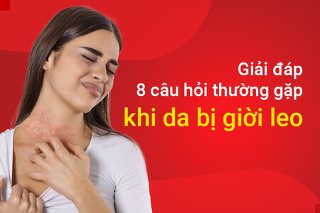 Giải đáp 8 câu hỏi thường gặp khi da bị giời leo