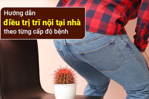 Hướng dẫn điều trị trĩ nội tại nhà theo từng cấp độ bệnh