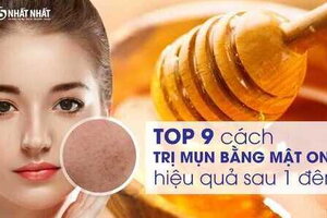 TOP 9 cách trị mụn bằng mật ong hiệu quả sau 1 đêm