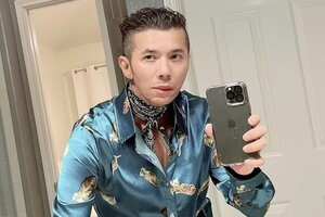 Ca sĩ Kasim Hoàng Vũ gây sốc với gương mặt biến dạng sau phẫu thuật xương hàm