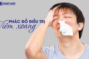 Phác đồ điều trị viêm xoang của Bộ Y Tế