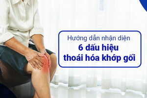 Hướng dẫn nhận diện 6 dấu hiệu thoái hóa khớp gối